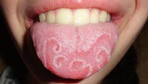 Maybe you would like to learn more about one of these? Menebak Kesehatan Seseorang Lewat Lidah