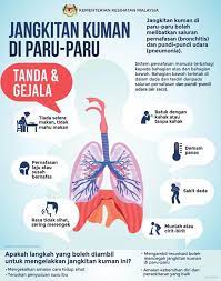 Penyakit ini kerap kali menyebabkan seseorang kanak. Siakap Keli Jangkitan Kuman Di Paru Paru Boleh Facebook