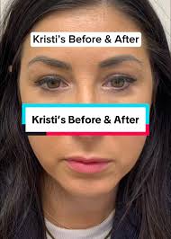 Kristi's Transformation Reveal: Stunning Results Explained