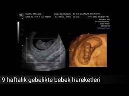 anne karninda 9 haftalik iki aylik bebegin muazzam hareketleri dr kagan kocatepe 4d ultrason youtube ikiz anne youtube