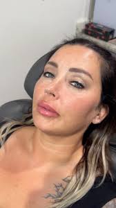 Muah 💋 , •••••••••••••••••••••••••••••, 👩🏼‍⚕️: Geneva R., FNP-BC, 📍:  Clackamas, OR, Inside Urban Colorz Salon, @urbancolorzsalon, 💉:  @revanesseusa @blake_revanesse , •••••••••••••••••••••••••••••, 🔗: ...