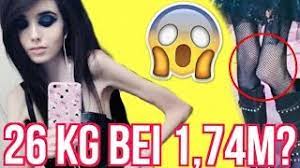Magersucht Youtuberin Hungert Sich Zu Tode Youtube