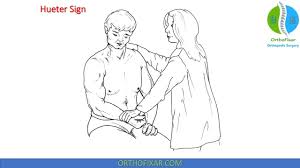 Image result for Yergason Test