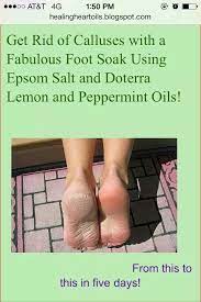End Unwanted Foot Calluses Epsom Salt Lemon And Peppermint Oils Foot Soak Oils Essential Oils