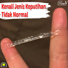 Beberapa jenis ikan air payau beserta gambarnya. Manfaat Rose V Jenis Jenis Keputihan Yang Tidak Normal