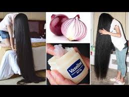 كيفية استخدام الفازلين والبصل لتطويل الشعر 2سنتيمتر في اليوم سريييع جداااا Youtube Grow Hair Hair Growth Diy Natural Hair Growth Remedies