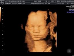 Avery's Story (@averysstoryfb) • Facebook