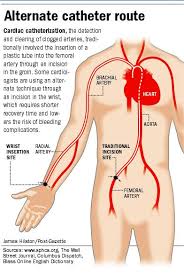 Cardiac Catheterization Cardiac Catheterization Cardiac Nursing Cardiac