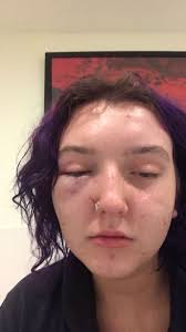 Just joined the group. Hit rock bottom with cocaine and alcohol even tried  using cannabis to stop the cocaine to then be stuck using all three! Ended  up in prison!! But today