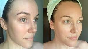 Oct 26, 2020 · how long it takes for collagen supplements to work depends on many factors including age, dosage, diet and lifestyle, and individual collagen needs. Do Collagen Supplements Actually Work Cosmopolitan Middle East