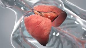 Get the facts on lung cancer types, symptoms, causes, treatment, and stages. Stage 3 Lung Cancer All That You Need To Know Scientific Animations
