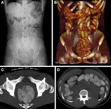 Image result for Body Stuffer