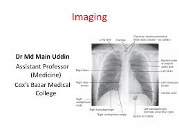 Image result for Chest XRay Interpretation