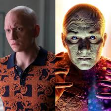 Anthony Carrigan says he was told he should quit acting because his  alopecia made him “not attractive anymore” “I've had it since I was a kid  and I would cover it up...