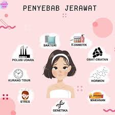 Penyebab Jerawat Ini Dia Penyebab Timbulnya Jerawat Nah Maka Dari Itu Kita Harus Menjaga Diri Dari Hal Ya Cilt Bakim Ipuclari Saglikli Cilt Bakimi Tips