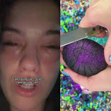 It's a #pickle-lover's dream come true! Nicole couldn't wait for the annual  pickle #festival outside #Pittsburgh. Three hours after eating all those  pickles, things went sour for her. Nicole had to be ...