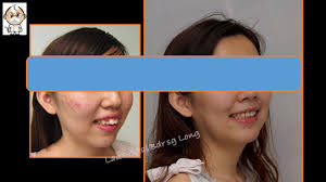 Get this location maps and gps coordinates. Lau Dental Bandar Sg Long Home Facebook