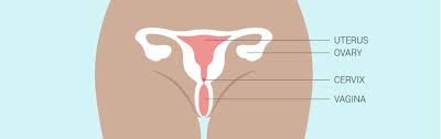 Cervical cancer often doesn't cause signs or symptoms until it has spread outside the cervix. Breast And Cervical Cancer Tigerlily Foundation