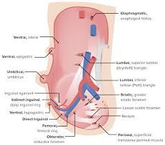 Hernias Abdominais Tipos E Tratamento Cirurgico Concise Medical Knowledge