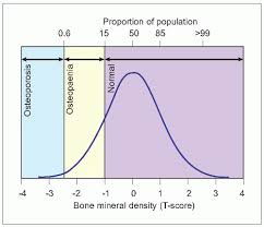 Epidemiology Risk And Risk Factors Musculoskeletal Key