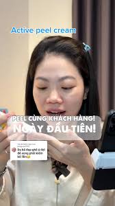 Peel Da Cùng Khách Hàng: Ngày Thứ 1 Thử Nghiệm