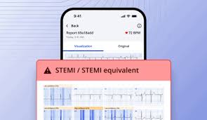 Image result for Electrocardiogram Validity