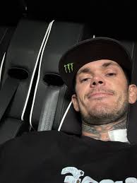 Trigger warning!! 1. Driving out of town 2 & 3 elbow reconstruction 4. Scan  of the elbow 5. Post opp metal work 6 broken femur 7. Pinned femur 8. Metal  work for