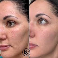 Kim Clark Advanced Aesthetics