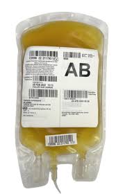 Image result for Plasma Transfusion