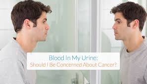 But if a person has bladder cancer, at. Blood In My Urine Should I Be Concerned About Cancer