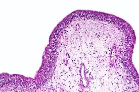 The vast majority of urethritis cases require antibiotic treatment. Urethritis Clinical Features Management Teachmesurgery