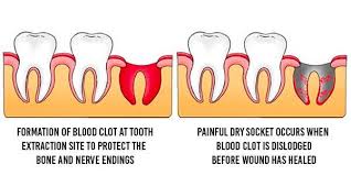 We also look at preparation and recovery times. Electronic Cigarettes And Oral Health Dr Zak Dental Care