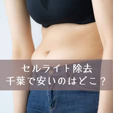 千葉で安くて人気のセルライト除去は おすすめのエステをまとめました アラサー美容の掟