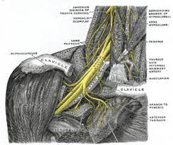 Parsonage Turner Syndrome Physiopedia