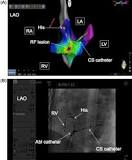 CARTO - an overview | ScienceDirect Topics