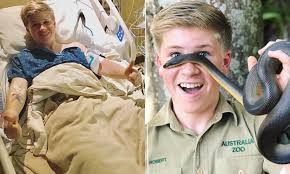 #australia zoo #steve irwin #peta #bindi irwin #bob irwin #terri irwin #irwin family #straya #conservation #animal conservation #wildlife conservation i saw the first mainstream news update on the coal seam gas protests on the channel 7 tv in king george square. Robert Irwin Rushed To Hospital For Emergency Surgery Daily Mail Online