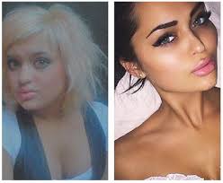 Instagram Girls Before Plastic Surgery Irina Tee Plastic Surgery Combination Skin Care Facial Contouring
