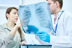 Struktur dinding sel yang kompleks tersebut menyebabkan bakteri mycobacterium tuberculosis bersifat tahan asam, yaitu apabila sekali diwarnai akan tahan terhadap upaya. Tbc Tuberkulosis Lifepack Id