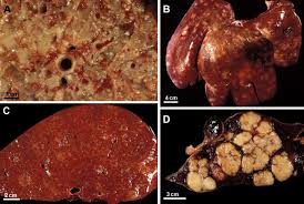 It's caused by the bacterium mycobacterium bovis (m. Pathology Of Bovine Tuberculosis Sciencedirect