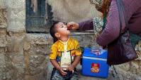 Image result for polio cases in pakistan 2021