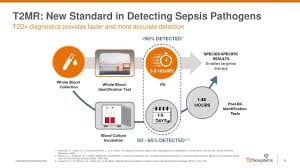 Get the latest t2 biosystems stock price and detailed information including ttoo news, historical charts and realtime prices. T2 Biosystems Why The Bears Are Wrong Nasdaq Ttoo Seeking Alpha