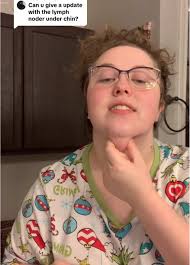 Swollen Lymph Neck Vs Knot under Chin