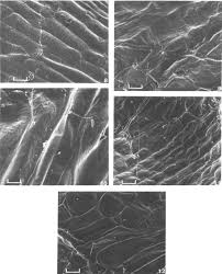 Image result for Nesaea sarcophylla