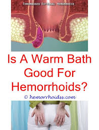 Why Do We Get Hemorrhoids Bleeding Hemorrhoids Hemorrhoid Remedies Hemorrhoid Relief