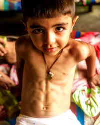 3 reviews of abs kids i would not recommend if you are going to be needing any sort of assistance with paperwork. Meet Archit Deswal From India Youngest Kid With 6 Pack Abs At The Age Of 4 5 Years