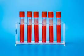 Blood Work 101 What Lab Results Really Mean