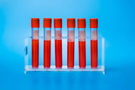 blood work 101 what lab results really mean