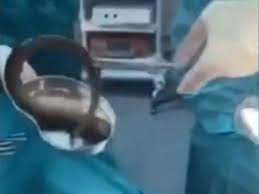 15 inch eel man's anus | SHOCKING: Man inserts 15-inch eel into his anus to  'cure constipation', doctors remove it from his gut | Trending & Viral News