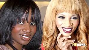 Black And White Bleaching Cream With Hydroquinone 1 5 Oz Black Women Are Desperate To Have Whiter Skin Shocking Skin Bleaching Skin Bleaching Whiter Skin Skin