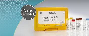 Kit carona , para pegar na mesma antena os satelites 84(b4), 70(c2) e 65(c1). Coronavirus Test Kit Receives Ce Label Clinical Diagnostics